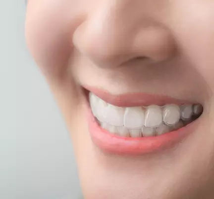 装着時に目立たない